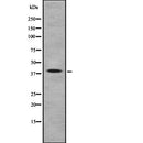 Western blot analysis of Arrestin-C using LOVO whole cell lysates