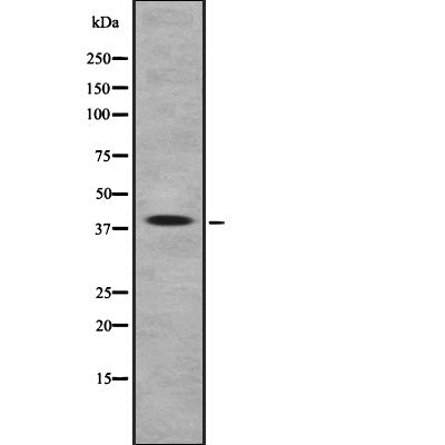 Western blot analysis of Arrestin-C using LOVO whole cell lysates