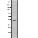 AF9021 at 1/100 staining Human liver cancer tissue by IHC-P. The sample was formaldehyde fixed and a heat mediated antigen retrieval step in citrate buffer was performed. The sample was then blocked and incubated with the antibody for 1.5 hours at 22¡ãC. An HRP conjugated goat anti-rabbit antibody was used as the secondary