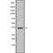 AF9021 at 1/100 staining Human liver cancer tissue by IHC-P. The sample was formaldehyde fixed and a heat mediated antigen retrieval step in citrate buffer was performed. The sample was then blocked and incubated with the antibody for 1.5 hours at 22¡ãC. An HRP conjugated goat anti-rabbit antibody was used as the secondary