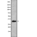 AF9023 staining 293 cells by IF/ICC. The sample were fixed with PFA and permeabilized in 0.1% Triton X-100,then blocked in 10% serum for 45 minutes at 25¡ãC. The primary antibody was diluted at 1/200 and incubated with the sample for 1 hour at 37¡ãC. An  Alexa Fluor 594 conjugated goat anti-rabbit IgG (H+L) antibody(Cat.