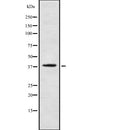 AF9031 staining LOVO by IF/ICC. The sample were fixed with PFA and permeabilized in 0.1% Triton X-100,then blocked in 10% serum for 45 minutes at 25¡ãC. The primary antibody was diluted at 1/200 and incubated with the sample for 1 hour at 37¡ãC. An  Alexa Fluor 594 conjugated goat anti-rabbit IgG (H+L) Ab, diluted at 1/600, was used as the secondary antibod