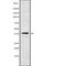 AF9031 staining LOVO by IF/ICC. The sample were fixed with PFA and permeabilized in 0.1% Triton X-100,then blocked in 10% serum for 45 minutes at 25¡ãC. The primary antibody was diluted at 1/200 and incubated with the sample for 1 hour at 37¡ãC. An  Alexa Fluor 594 conjugated goat anti-rabbit IgG (H+L) Ab, diluted at 1/600, was used as the secondary antibod