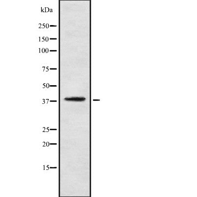 AF9031 staining LOVO by IF/ICC. The sample were fixed with PFA and permeabilized in 0.1% Triton X-100,then blocked in 10% serum for 45 minutes at 25¡ãC. The primary antibody was diluted at 1/200 and incubated with the sample for 1 hour at 37¡ãC. An  Alexa Fluor 594 conjugated goat anti-rabbit IgG (H+L) Ab, diluted at 1/600, was used as the secondary antibod