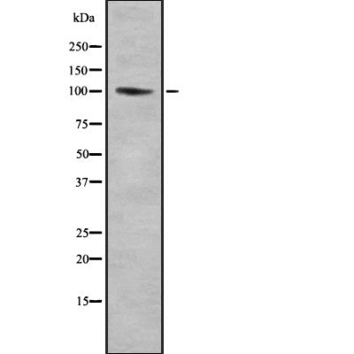 Western blot analysis of Centrobin using Jurkat whole cell lysates