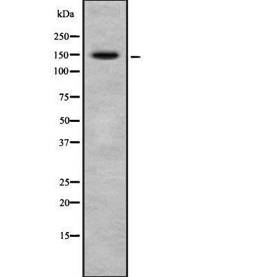 Western blot analysis of CRSP130 using A549 whole cell lysates