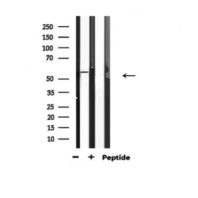 AF3176 staining Hela by IF/ICC. The sample were fixed with PFA and permeabilized in 0.1% Triton X-100,then blocked in 10% serum for 45 minutes at 25¡ãC. The primary antibody was diluted at 1/200 and incubated with the sample for 1 hour at 37¡ãC. An  Alexa Fluor 594 conjugated goat anti-rabbit IgG (H+L) Ab, diluted at 1/600, was used as the secondary antibod