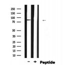 Western blot analysis of Phospho-EZH2?S475 expression in Rat muscle lysate 