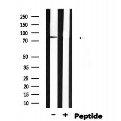 Western blot analysis of Phospho-EZH2?S475 expression in Rat muscle lysate 