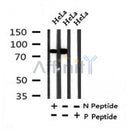 AF7319 at 1/100 staining rat kidney tissue sections by IHC-P. The tissue was formaldehyde fixed and a heat mediated antigen retrieval step in citrate buffer was performed. The tissue was then blocked and incubated with the antibody for 1.5 hours at 22¡ãC. An HRP conjugated goat anti-rabbit antibody was used as the secondary