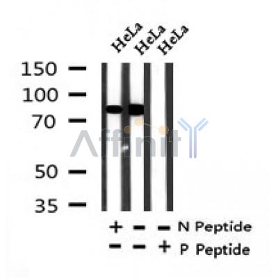 AF7319 at 1/100 staining rat kidney tissue sections by IHC-P. The tissue was formaldehyde fixed and a heat mediated antigen retrieval step in citrate buffer was performed. The tissue was then blocked and incubated with the antibody for 1.5 hours at 22¡ãC. An HRP conjugated goat anti-rabbit antibody was used as the secondary