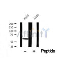 Western blot analysis of HBP1 in lysates of A549 , using HBP1 Antibody(AF7632).