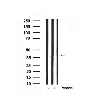 Western blot analysis of LDHA in lysates of HeLa?, using LDHA Antibody(AF7672).