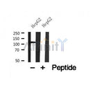 Western blot analysis of ACK1 in lysates of HepG2 , using ACK1 Antibody(AF7859).