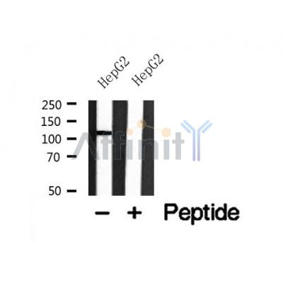 Western blot analysis of ACK1 in lysates of HepG2 , using ACK1 Antibody(AF7859).