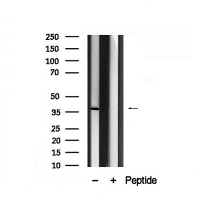 Western blot analysis of p40phox in lysates of Jurkat?, using p40phox Antibody(AF7892).