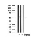 Western blot analysis of LKB1 in lysates of HeLa  , using LKB1 Antibody(AF7898).