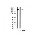 Western blot analysis of extracts of Human Lung tissue sample,using Gli3 Antibody(AF7949).