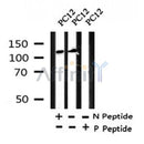 Western blot analysis of Phospho-ULK1 (Ser638) in lysates of PC12?, using Phospho-ULK1 (Ser638) Antibody(AF4386).