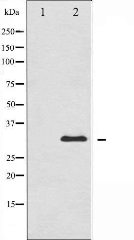 AF6415 at 1/100 staining Human lung tissue by IHC-P. The sample was formaldehyde fixed and a heat mediated antigen retrieval step in citrate buffer was performed. The sample was then blocked and incubated with the antibody for 1.5 hours at 22¡ãC. An HRP conjugated goat anti-rabbit antibody was used as the secondary