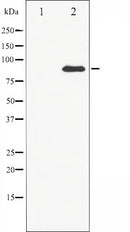 AF6437 at 1/100 staining Human prostate tissue by IHC-P. The sample was formaldehyde fixed and a heat mediated antigen retrieval step in citrate buffer was performed. The sample was then blocked and incubated with the antibody for 1.5 hours at 22¡ãC. An HRP conjugated goat anti-rabbit antibody was used as the secondary