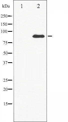 AF6437 at 1/100 staining Human prostate tissue by IHC-P. The sample was formaldehyde fixed and a heat mediated antigen retrieval step in citrate buffer was performed. The sample was then blocked and incubated with the antibody for 1.5 hours at 22¡ãC. An HRP conjugated goat anti-rabbit antibody was used as the secondary