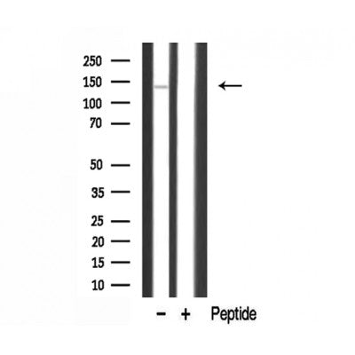 DF3306 staining  HuvEc cells by IF/ICC. The sample were fixed with PFA and permeabilized in 0.1% Triton X-100,then blocked in 10% serum for 45 minutes at 25¡ãC. The primary antibody was diluted at 1/200 and incubated with the sample for 1 hour at 37¡ãC. An  Alexa Fluor 594 conjugated goat anti-rabbit IgG (H+L) antibody(Cat.# S0006), diluted at 1/600, was used as secondary antibod