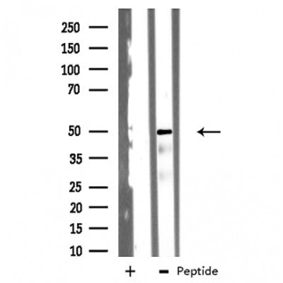 DF3314 staining Hela by IF/ICC. The sample were fixed with PFA and permeabilized in 0.1% Triton X-100,then blocked in 10% serum for 45 minutes at 25¡ãC. The primary antibody was diluted at 1/200 and incubated with the sample for 1 hour at 37¡ãC. An  Alexa Fluor 594 conjugated goat anti-rabbit IgG (H+L) Ab, diluted at 1/600, was used as the secondary antibod