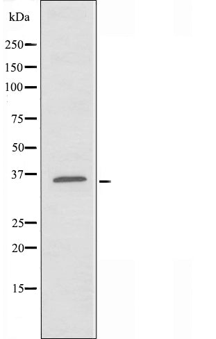 DF3325 staining HuvEc by IF/ICC. The sample were fixed with PFA and permeabilized in 0.1% Triton X-100,then blocked in 10% serum for 45 minutes at 25¡ãC. The primary antibody was diluted at 1/200 and incubated with the sample for 1 hour at 37¡ãC. An  Alexa Fluor 594 conjugated goat anti-rabbit IgG (H+L) Ab, diluted at 1/600, was used as the secondary antibod