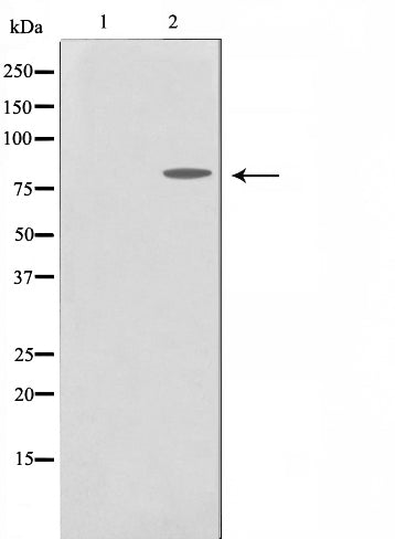 Western blot analysis on MDA-MB-435 cell lysate using MMP15 Antibody. The lane on the left is treated with the antigen-specific peptide.
