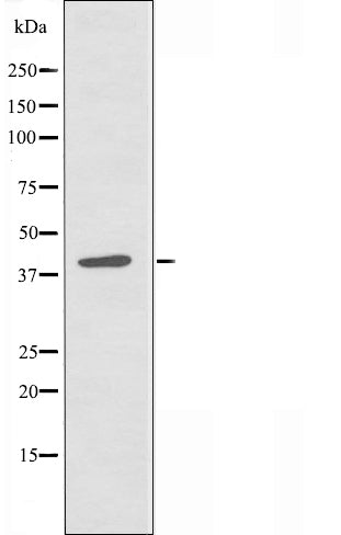 DF3435 staining HuvEc cells by IF/ICC. The sample were fixed with PFA and permeabilized in 0.1% Triton X-100,then blocked in 10% serum for 45 minutes at 25¡ãC. The primary antibody was diluted at 1/200 and incubated with the sample for 1 hour at 37¡ãC. An  Alexa Fluor 594 conjugated goat anti-rabbit IgG (H+L) antibody(Cat.# S0006), diluted at 1/600, was used as secondary antibod