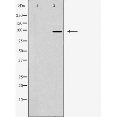 DF3393 at 1/100 staining Mouse testis tissue by IHC-P. The sample was formaldehyde fixed and a heat mediated antigen retrieval step in citrate buffer was performed. The sample was then blocked and incubated with the antibody for 1.5 hours at 22¡ãC. An HRP conjugated goat anti-rabbit antibody was used as the secondary