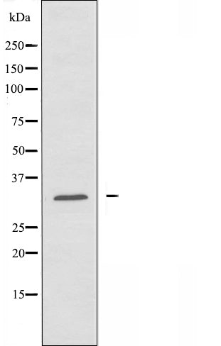 DF3406 staining Hela by IF/ICC. The sample were fixed with PFA and permeabilized in 0.1% Triton X-100,then blocked in 10% serum for 45 minutes at 25¡ãC. The primary antibody was diluted at 1/200 and incubated with the sample for 1 hour at 37¡ãC. An  Alexa Fluor 594 conjugated goat anti-rabbit IgG (H+L) Ab, diluted at 1/600, was used as the secondary antibod