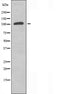DF3408 staining  Hela cells by IF/ICC. The sample were fixed with PFA and permeabilized in 0.1% Triton X-100,then blocked in 10% serum for 45 minutes at 25¡ãC. The primary antibody was diluted at 1/200 and incubated with the sample for 1 hour at 37¡ãC. An  Alexa Fluor 594 conjugated goat anti-rabbit IgG (H+L) antibody(Cat.# S0006), diluted at 1/600, was used as secondary antibod