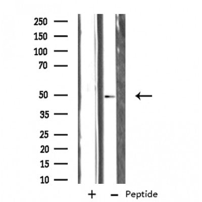DF3446 staining  HepG2 cells by IF/ICC. The sample were fixed with PFA and permeabilized in 0.1% Triton X-100,then blocked in 10% serum for 45 minutes at 25¡ãC. The primary antibody was diluted at 1/200 and incubated with the sample for 1 hour at 37¡ãC. An  Alexa Fluor 594 conjugated goat anti-rabbit IgG (H+L) antibody(Cat.# S0006), diluted at 1/600, was used as secondary antibod