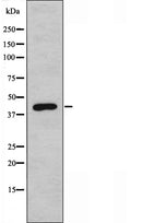 DF3478 staining  LOVO cells by IF/ICC. The sample were fixed with PFA and permeabilized in 0.1% Triton X-100,then blocked in 10% serum for 45 minutes at 25¡ãC. The primary antibody was diluted at 1/200 and incubated with the sample for 1 hour at 37¡ãC. An  Alexa Fluor 594 conjugated goat anti-rabbit IgG (H+L) antibody(Cat.