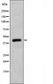 DF3478 staining  LOVO cells by IF/ICC. The sample were fixed with PFA and permeabilized in 0.1% Triton X-100,then blocked in 10% serum for 45 minutes at 25¡ãC. The primary antibody was diluted at 1/200 and incubated with the sample for 1 hour at 37¡ãC. An  Alexa Fluor 594 conjugated goat anti-rabbit IgG (H+L) antibody(Cat.