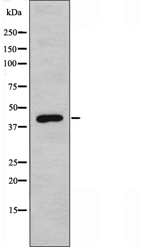 DF3478 staining  LOVO cells by IF/ICC. The sample were fixed with PFA and permeabilized in 0.1% Triton X-100,then blocked in 10% serum for 45 minutes at 25¡ãC. The primary antibody was diluted at 1/200 and incubated with the sample for 1 hour at 37¡ãC. An  Alexa Fluor 594 conjugated goat anti-rabbit IgG (H+L) antibody(Cat.