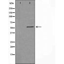 DF3835 at 1/100 staining Mouse testis tissue by IHC-P. The sample was formaldehyde fixed and a heat mediated antigen retrieval step in citrate buffer was performed. The sample was then blocked and incubated with the antibody for 1.5 hours at 22¡ãC. An HRP conjugated goat anti-rabbit antibody was used as the secondary