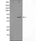 DF3835 at 1/100 staining Mouse testis tissue by IHC-P. The sample was formaldehyde fixed and a heat mediated antigen retrieval step in citrate buffer was performed. The sample was then blocked and incubated with the antibody for 1.5 hours at 22¡ãC. An HRP conjugated goat anti-rabbit antibody was used as the secondary