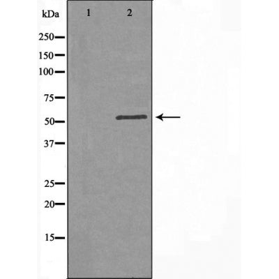 DF3835 at 1/100 staining Mouse testis tissue by IHC-P. The sample was formaldehyde fixed and a heat mediated antigen retrieval step in citrate buffer was performed. The sample was then blocked and incubated with the antibody for 1.5 hours at 22¡ãC. An HRP conjugated goat anti-rabbit antibody was used as the secondary