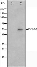 Western blot analysis on Jurkat cell lysate using ZIC1/2/3 Antibody,The lane on the left is treated with the antigen-specific peptide.
