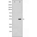 Western blot analysis of extracts from Rat brain, using Annexin II Antibody. The lane on the left was treated with blocking peptide.