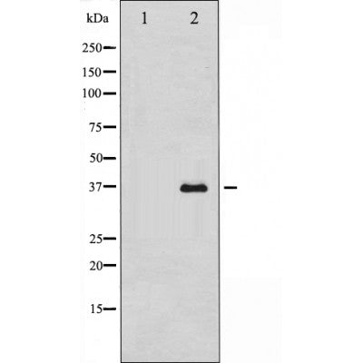 Western blot analysis of extracts from Rat brain, using Annexin II Antibody. The lane on the left was treated with blocking peptide.