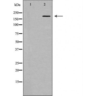 DF6651 at 1/100 staining Mouse kidney tissue by IHC-P. The sample was formaldehyde fixed and a heat mediated antigen retrieval step in citrate buffer was performed. The sample was then blocked and incubated with the antibody for 1.5 hours at 22¡ãC. An HRP conjugated goat anti-rabbit antibody was used as the secondary