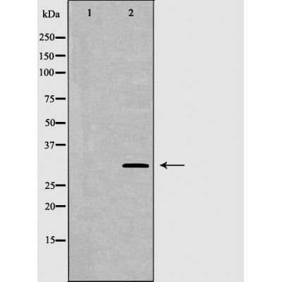 DF6675 at 1/100 staining Rat liver tissue by IHC-P. The sample was formaldehyde fixed and a heat mediated antigen retrieval step in citrate buffer was performed. The sample was then blocked and incubated with the antibody for 1.5 hours at 22¡ãC. An HRP conjugated goat anti-rabbit antibody was used as the secondary