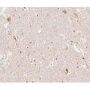 AF0138 at 1/200 staining human brain tissue sections by IHC-P. The tissue was formaldehyde fixed and a heat mediated antigen retrieval step in citrate buffer was performed. The tissue was then blocked and incubated with the antibody for 1.5 hours at 22¡ãC. An HRP conjugated goat anti-rabbit antibody was used as the secondary