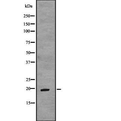 DF2248 at 1/100 staining Mouse muscle tissue by IHC-P. The sample was formaldehyde fixed and a heat mediated antigen retrieval step in citrate buffer was performed. The sample was then blocked and incubated with the antibody for 1.5 hours at 22¡ãC. An HRP conjugated goat anti-rabbit antibody was used as the secondary