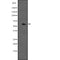 DF2615 at 1/100 staining Mouse kidney tissue by IHC-P. The sample was formaldehyde fixed and a heat mediated antigen retrieval step in citrate buffer was performed. The sample was then blocked and incubated with the antibody for 1.5 hours at 22¡ãC. An HRP conjugated goat anti-rabbit antibody was used as the secondary