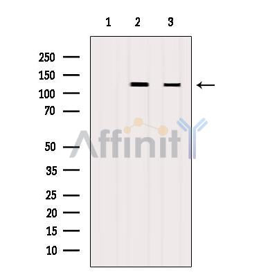 Western blot analysis of extracts from various samples, using FAK Antibody.
 Lane 1: B16F10 cells treated with blocking peptide;
 Lane 2: B16F10 cells;
Lane 3: Hybridoma cells;